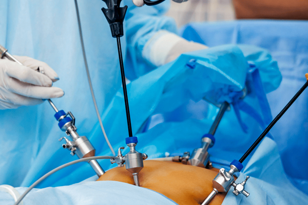 Laparoscopy Doctor in Vasant Vihar Laparoscopy Doctor in Vasant Vihar